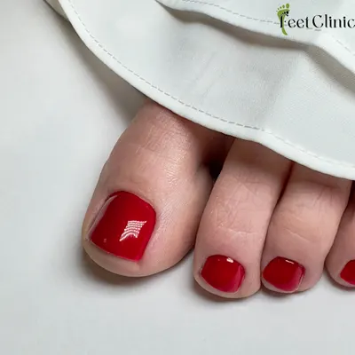 Feet Clinic - Podolog Gdynia | Pedicure | Leczenie Ran | Szkolenia | Paznokcie Wrastające